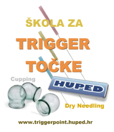 ŠKOLA ZA TRIGGER (ASHI) TOČKE